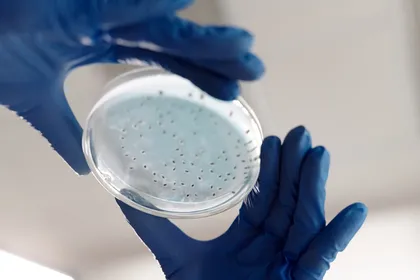 A gloved hand holds a petri dish with Legionella colonies growing on a light blue agar
